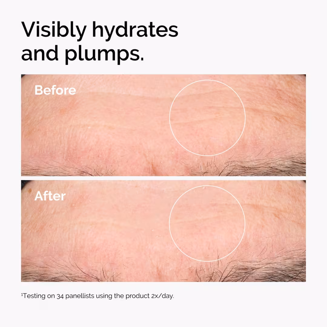 The Ordinary Hyaluronic Acid 2% + B5 Hydrating Serum with Ceramides Item #3176 - Image 3